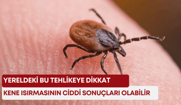 kene-manset.png