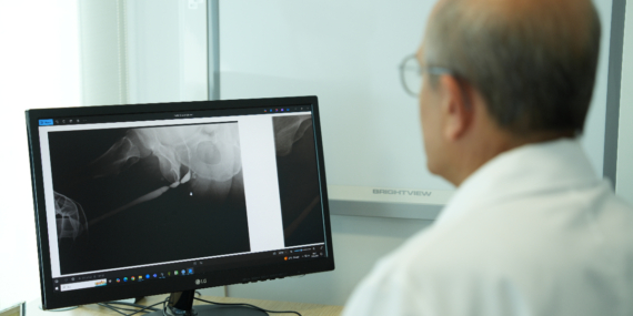 Üretra Darlığı: Tedavi Yöntemleri ve Çözümler