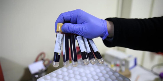 Demir Eksikliğine Karşı 8 Güçlü Besin Kaynağı