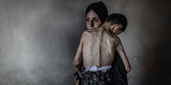 Gazze’de Açlık Kurbanı: 455 Sivil Hayatını Kaybetti