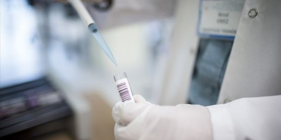 Yeni Mpox Varyantı Endişe Yarattı! Aşı Çağrısı Var