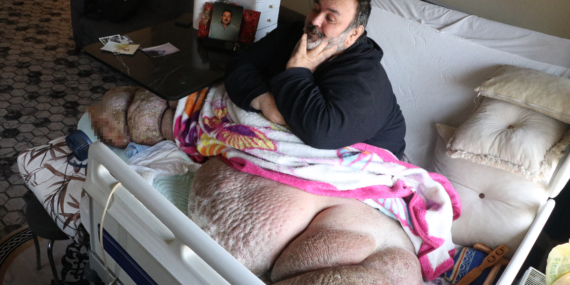 12 Yıldır Yataklarda Savaşan Engin’in Umudu