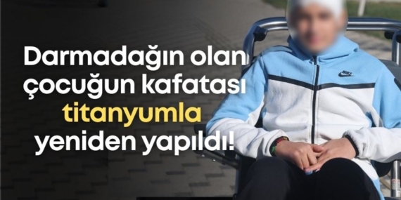 darmadagin-olan-cocugun-kafatasi-titanyumla-yeniden-yapildi.jpg